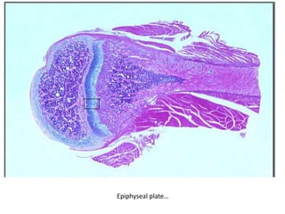 Epiphyseal plate…
 