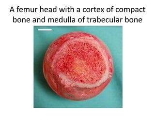 A femur head with a cortex of compact
 bone and medulla of trabecular bone
 