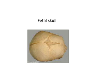 Fetal skull
 
