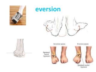 eversion
 