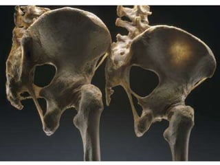 Skeletal System Slides