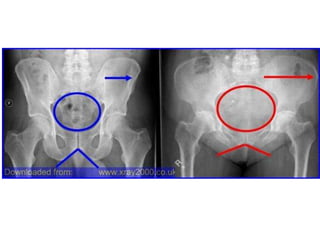 Skeletal System Slides