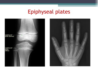 Epiphyseal plates
 