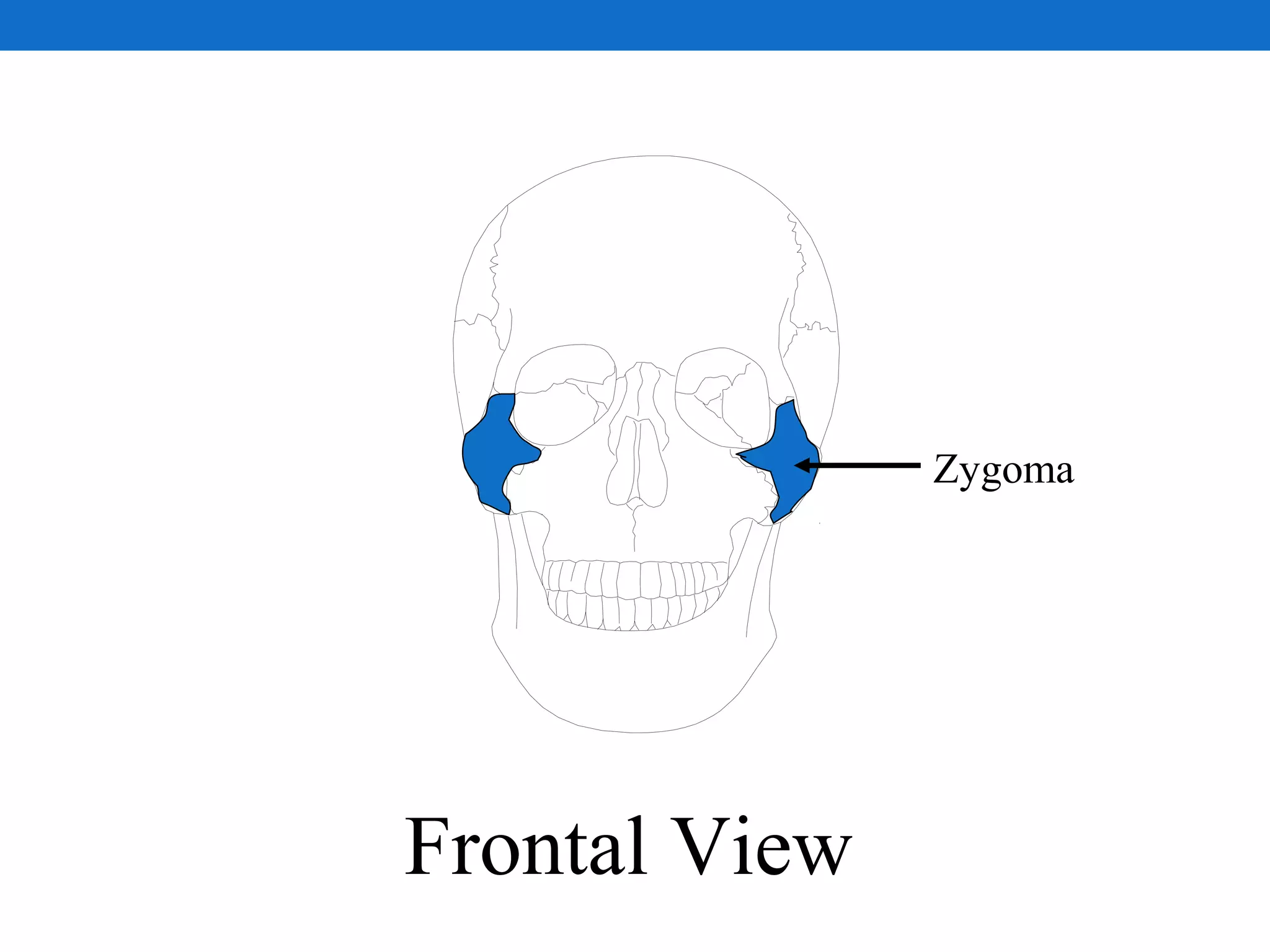 Zygoma
Frontal View
 
