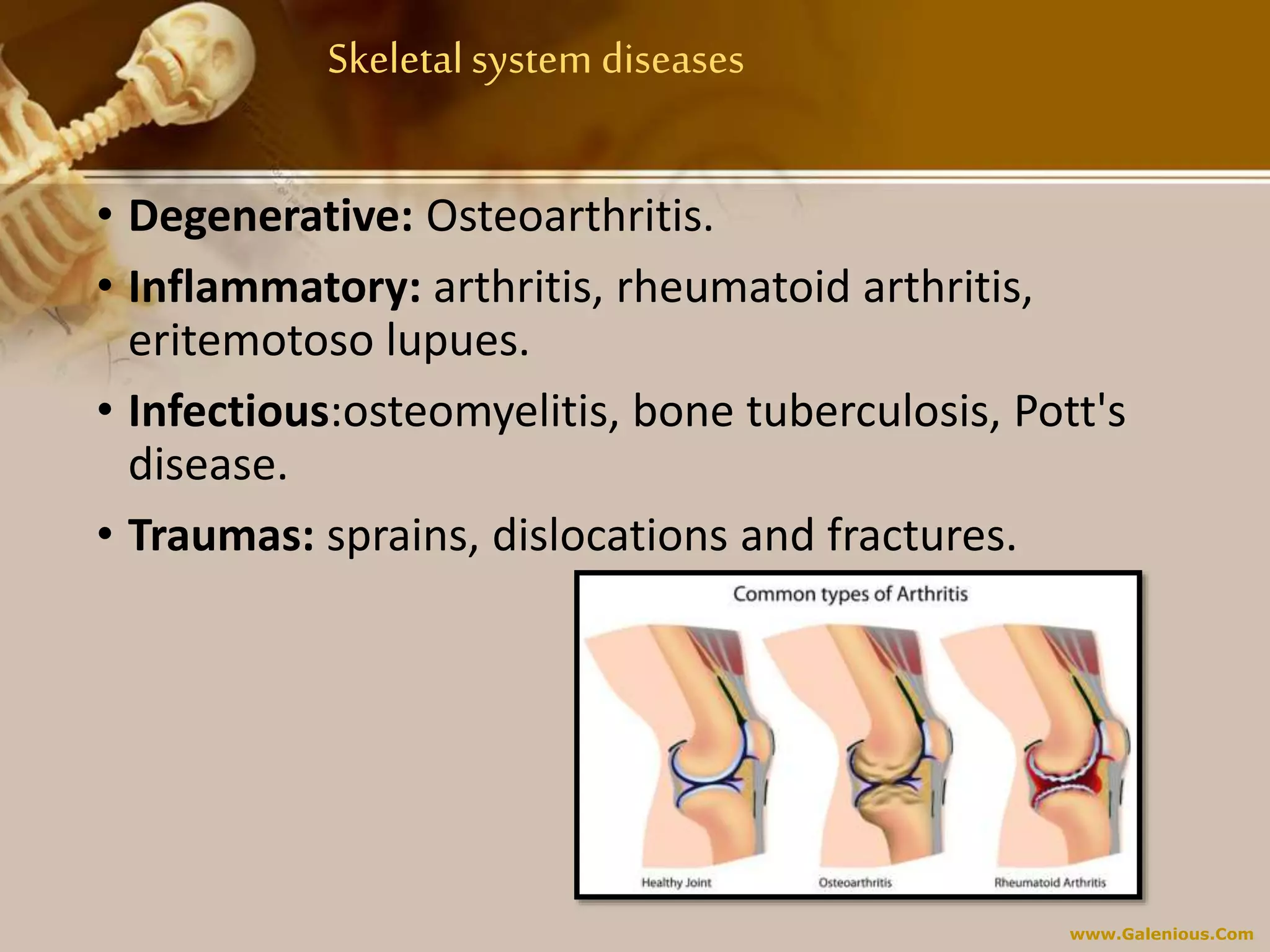 www.Galenious.Com
Skeletalsystem diseases
• Degenerative: Osteoarthritis.
• Inflammatory: arthritis, rheumatoid arthritis,
eritemotoso lupues.
• Infectious:osteomyelitis, bone tuberculosis, Pott's
disease.
• Traumas: sprains, dislocations and fractures.
 