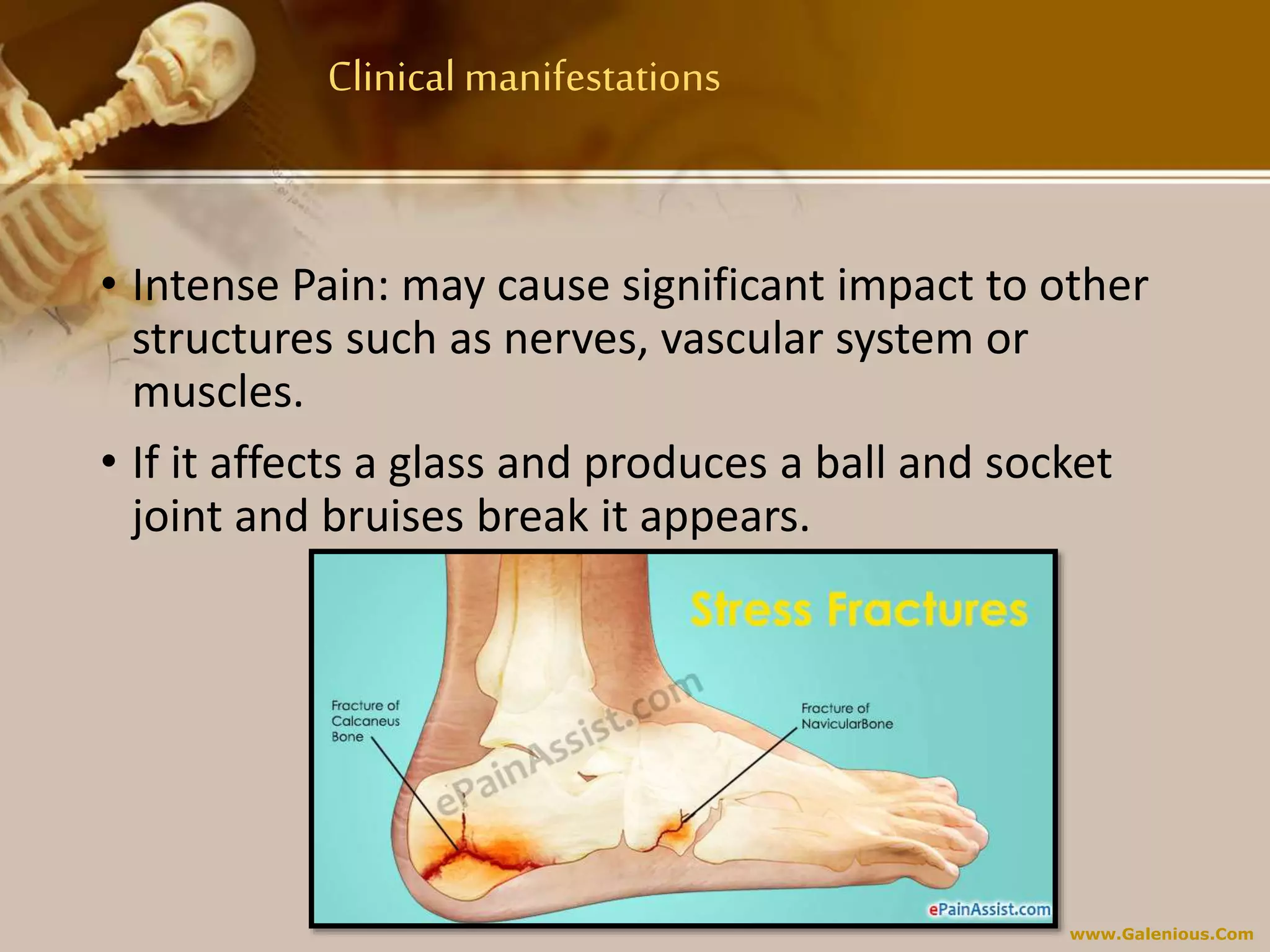 www.Galenious.Com
Clinical manifestations
• Intense Pain: may cause significant impact to other
structures such as nerves, vascular system or
muscles.
• If it affects a glass and produces a ball and socket
joint and bruises break it appears.
 