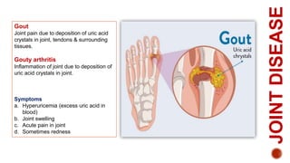 Gout Racgp Skeletal system | PPTX