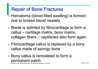 Repair of Bone Fractures
• Hematoma (blood-filled swelling) is formed
Slide 5.28
Copyright © 2003 Pearson Education, Inc. publishing as Benjamin Cummings
due to broken blood vessels
• Break is splinted by fibrocartilage to form a
callus – cartilage matrix, bony matrix,
collagen fibers – capillaries also form again
• Fibrocartilage callus is replaced by a bony
callus made of spongy bone
• Bony callus is remodeled to form a
permanent patch
 