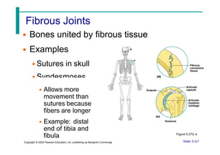 Fibrous Joints
• Bones united by fibrous tissue
• Examples
• Sutures in skull
• Syndesmoses
• Allows more
movement than
sutures because
fibers are longer
• Example: distal
end of tibia and
fibula Figure 5.27d, e
Slide 5.67
Copyright © 2003 Pearson Education, Inc. publishing as Benjamin Cummings
 