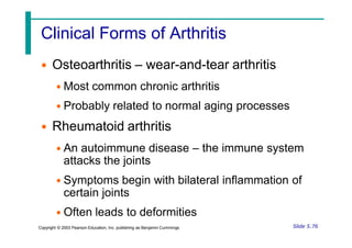 Clinical Forms of Arthritis
• Osteoarthritis – wear-and-tear arthritis
• Most common chronic arthritis
• Probably related to normal aging processes
• Rheumatoid arthritis
• An autoimmune disease – the immune system
attacks the joints
• Symptoms begin with bilateral inflammation of
certain joints
• Often leads to deformities
Slide 5.76
Copyright © 2003 Pearson Education, Inc. publishing as Benjamin Cummings
 