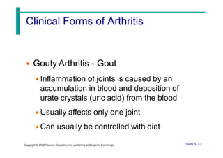 Clinical Forms of Arthritis
• Gouty Arthritis - Gout
• Inflammation of joints is caused by an
accumulation in blood and deposition of
urate crystals (uric acid) from the blood
• Usually affects only one joint
• Can usually be controlled with diet
Slide 5.77
Copyright © 2003 Pearson Education, Inc. publishing as Benjamin Cummings
 