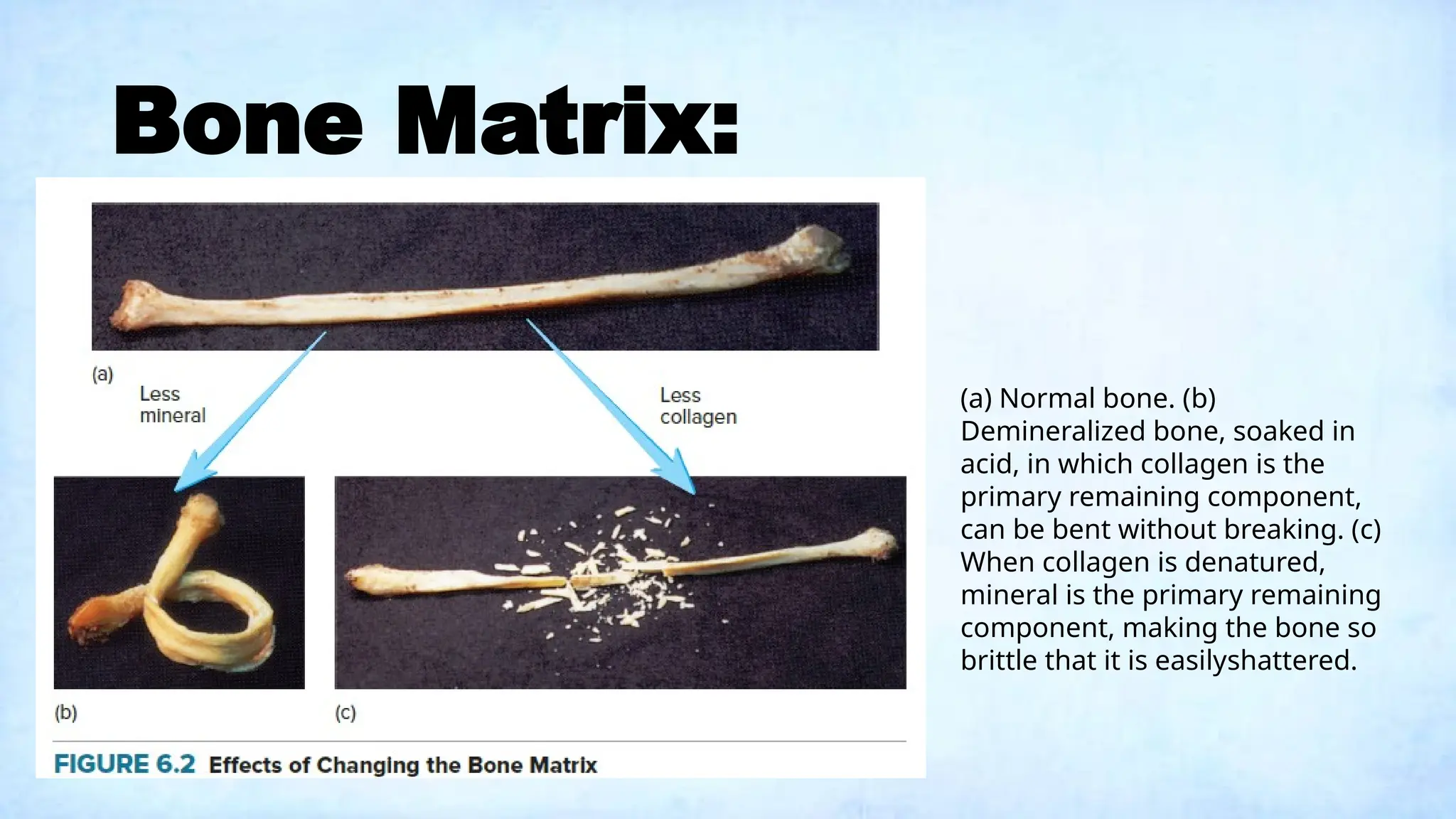 Bone Matrix:
(a) Normal bone. (b)
Demineralized bone, soaked in
acid, in which collagen is the
primary remaining component,
can be bent without breaking. (c)
When collagen is denatured,
mineral is the primary remaining
component, making the bone so
brittle that it is easilyshattered.
 