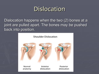 Skeletal System PowerPoint Presentation. | PPT