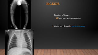 SKELETAL SYSTEM - MBBS - LECTURE.pptx