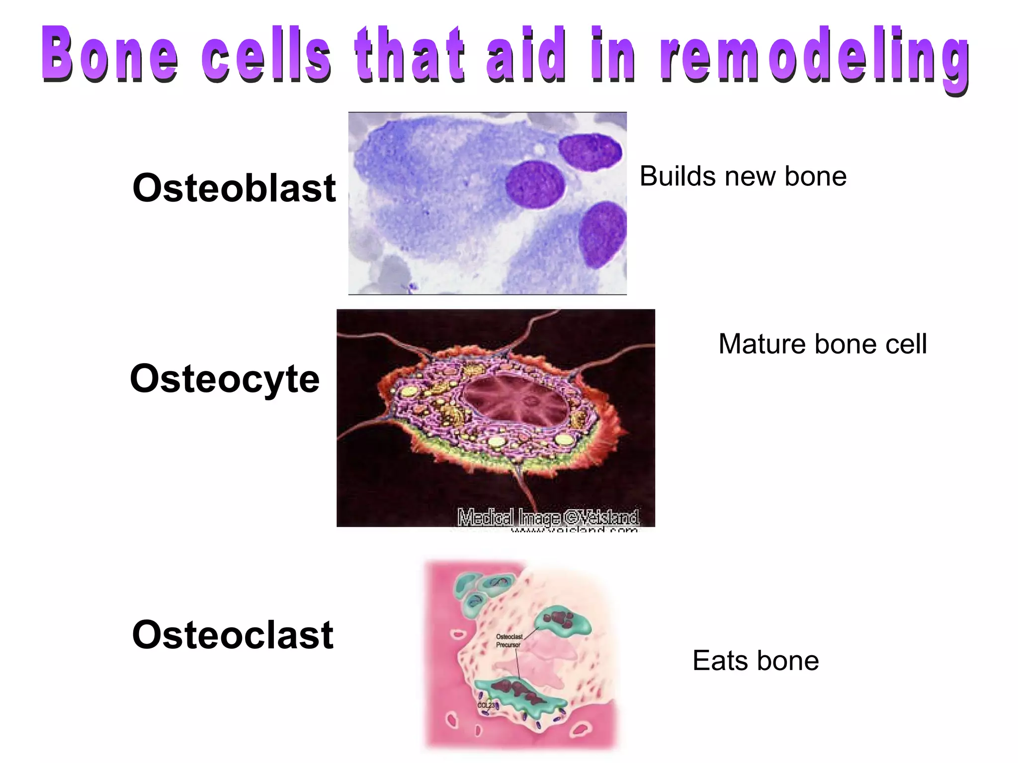 Osteoblast Osteocyte Osteoclast Eats bone Builds new bone Mature bone cell Bone cells that aid in remodeling 