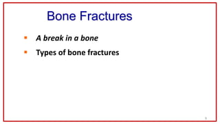 9
Bone Fractures
 A break in a bone
 Types of bone fractures
 