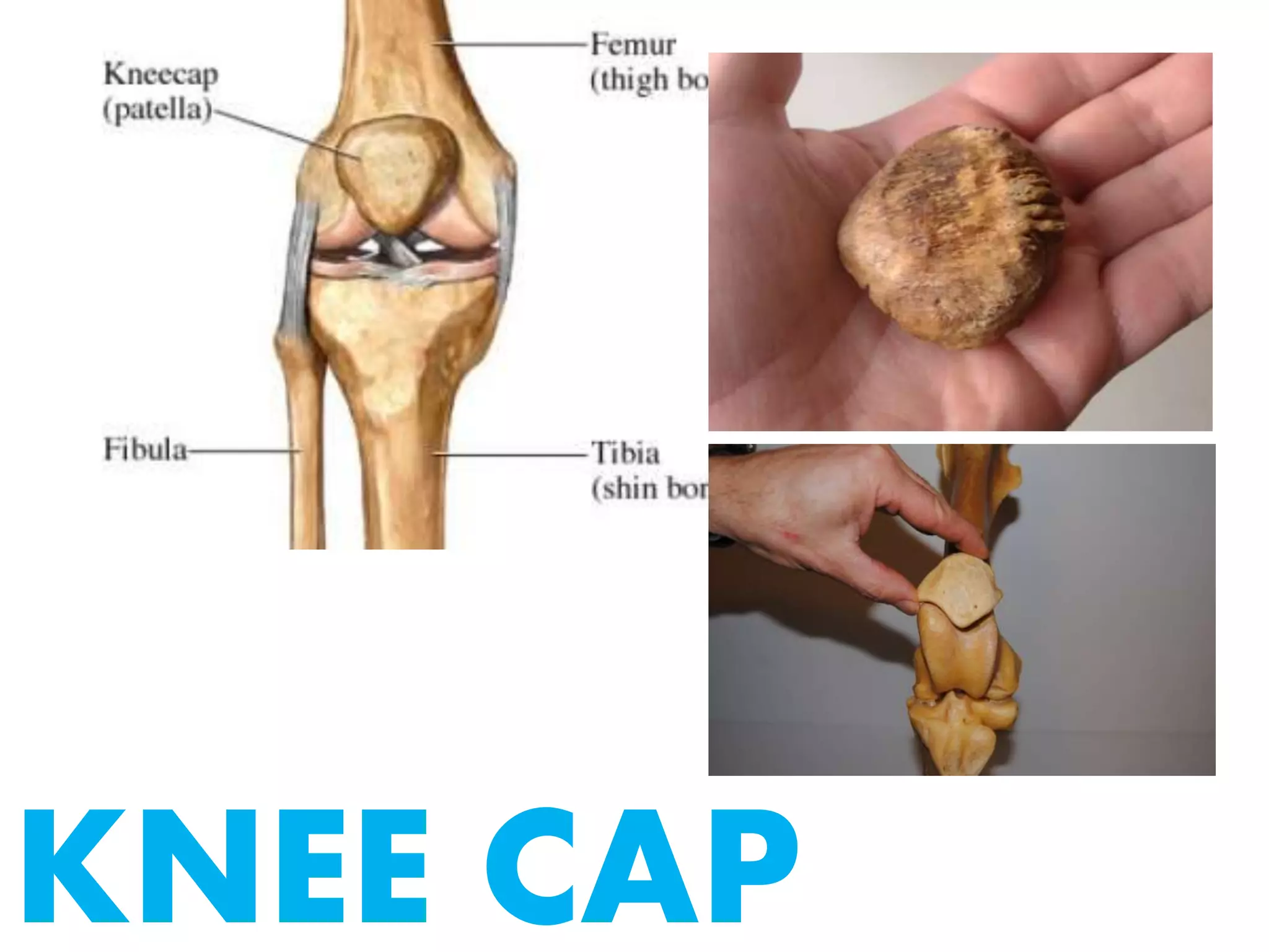 KNEE CAP
 