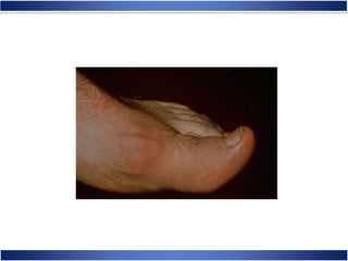 Skeletal System Anatomy and Physiology