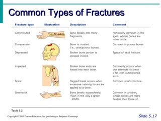skeletal system bone classification & structure powerpoint (chapter 6).ppt