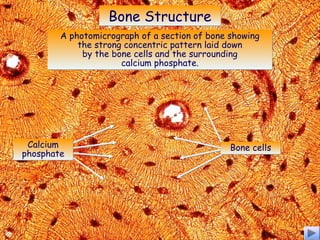 Bone StructureBone Structure
A photomicrograph of a section of bone showing
the strong concentric pattern laid down
by the bone cells and the surrounding
calcium phosphate.
A photomicrograph of a section of bone showing
the strong concentric pattern laid down
by the bone cells and the surrounding
calcium phosphate.
Calcium
phosphate
Calcium
phosphate
Bone cellsBone cells
 