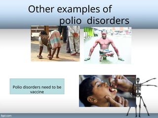Pollio Examples Skeletal system Part 2--------------.pptx