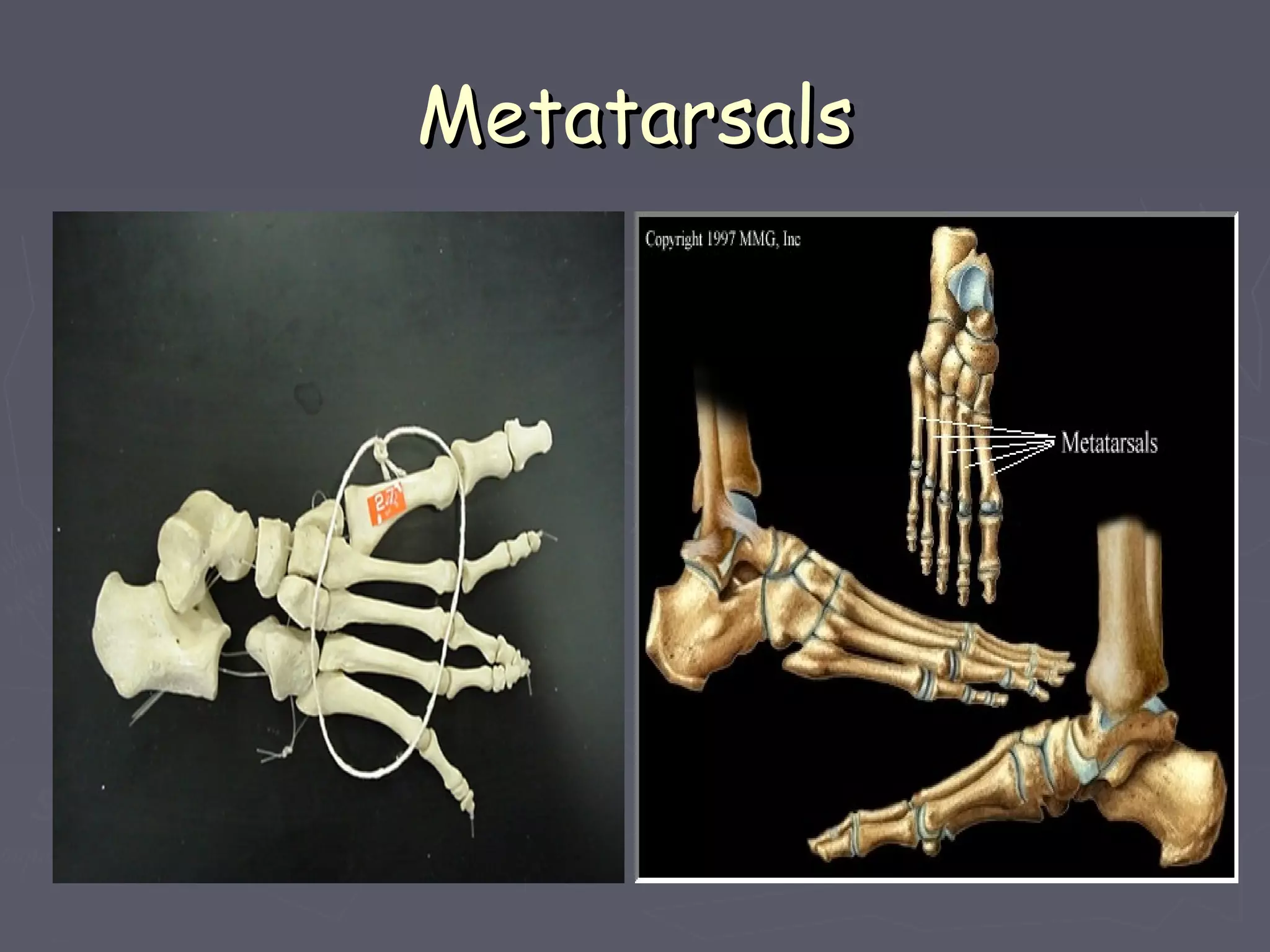 MetatarsalsMetatarsals
 