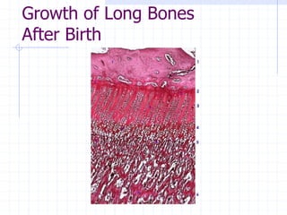 Growth of Long Bones
After Birth
 