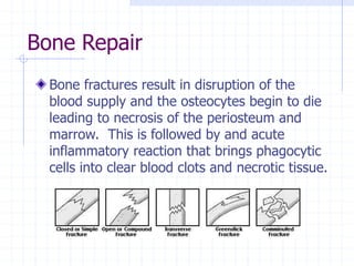 Bone Repair
Bone fractures result in disruption of the
blood supply and the osteocytes begin to die
leading to necrosis of the periosteum and
marrow. This is followed by and acute
inflammatory reaction that brings phagocytic
cells into clear blood clots and necrotic tissue.
 