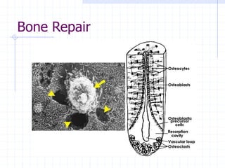 Bone Repair
 