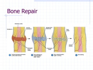 Bone Repair
 