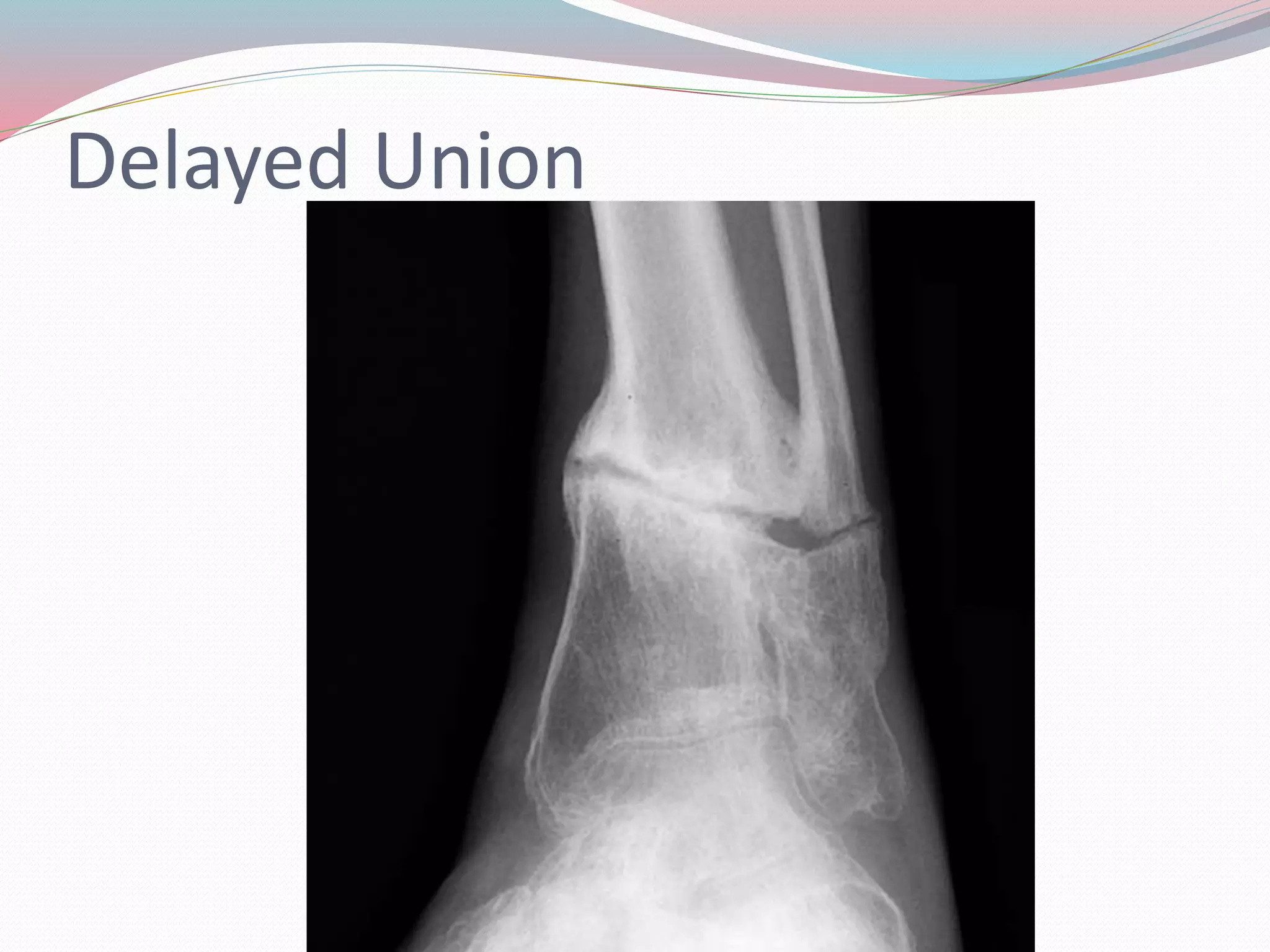 Skeletal trauma imaging | PPTX