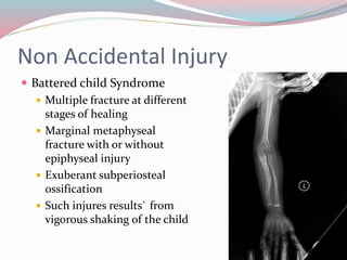 Non Accidental Injury
 Battered child Syndrome
 Multiple fracture at different
stages of healing
 Marginal metaphyseal
fracture with or without
epiphyseal injury
 Exuberant subperiosteal
ossification
 Such injures results` from
vigorous shaking of the child
 