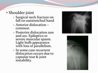  Shoulder joint
 Surgical neck fracture on
fall on outstretched hand
 Anterior dislocation –
common
 Posterior dislocation rare
and ass. Epileptics or
severe muscular spasm.
Light bulb appearance
with loss of parallelism.
 In some case recurrent
dislocation occurs due to
capsular tear & joint
instability.
 