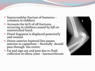  Supracondylar fracture of humerus –
common in children.
 Accounts for 60% of all fractures
occurring in children caused by fall on
outstretched hand.
 Distal fragment is displaced posteriorly
and rotated
 Hence anterior humeral line passes
anterior to capitellum – Normally should
pass through the centre.
 Fat pad sign ant and post due to fluid
collection in elbow joint - haemarrthrosis
 