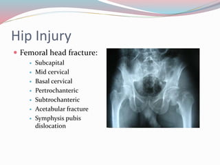 Hip Injury
 Femoral head fracture:
 Subcapital
 Mid cervical
 Basal cervical
 Pertrochanteric
 Subtrochanteric
 Acetabular fracture
 Symphysis pubis
dislocation
 