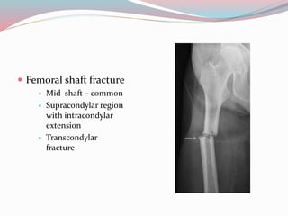  Femoral shaft fracture
 Mid shaft – common
 Supracondylar region
with intracondylar
extension
 Transcondylar
fracture
 