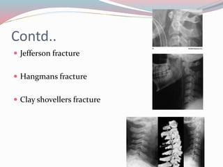 Contd..
 Jefferson fracture
 Hangmans fracture
 Clay shovellers fracture
 
