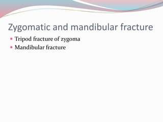 Zygomatic and mandibular fracture
 Tripod fracture of zygoma
 Mandibular fracture
 