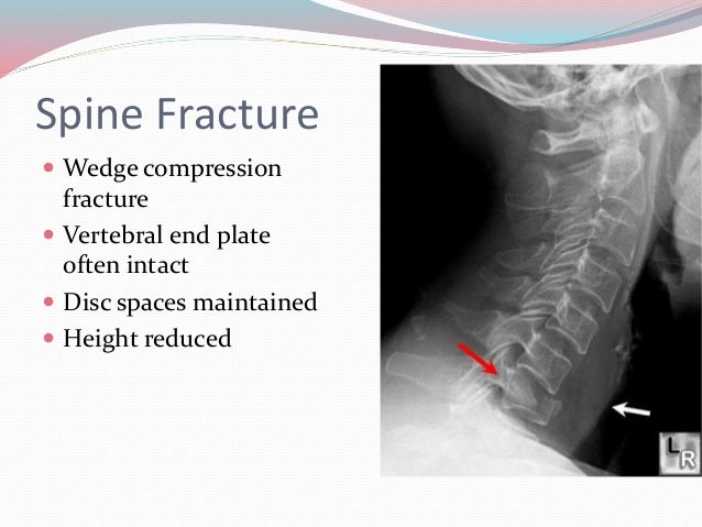 Skeletal trauma imaging