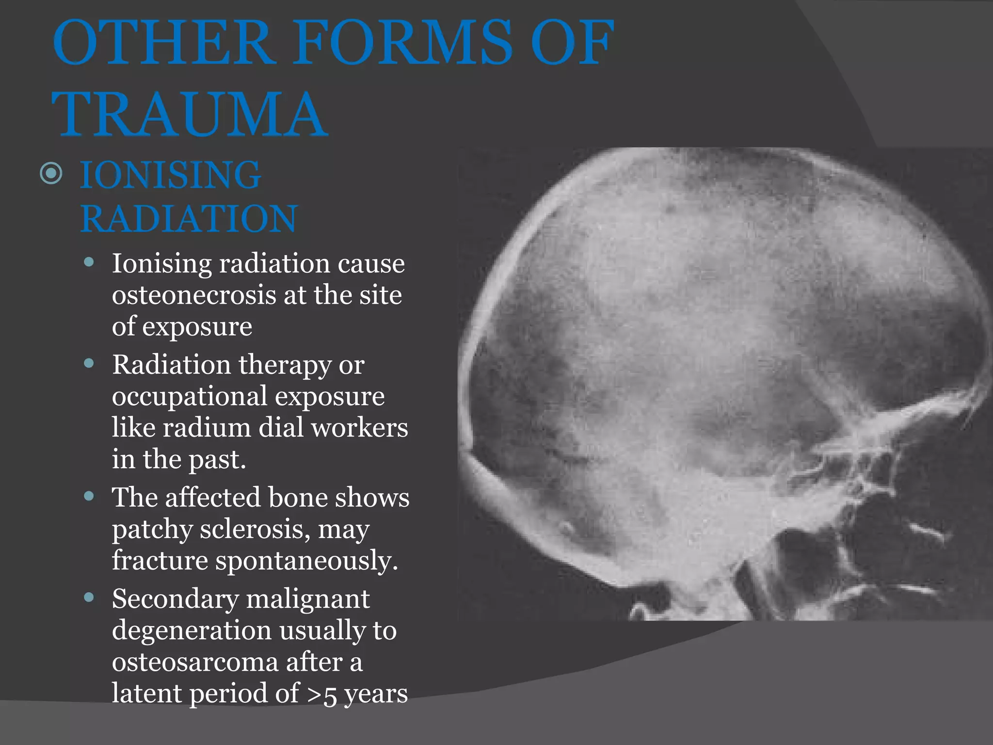Skeletal Trauma And Healing Its Radiological Aspects | PPT