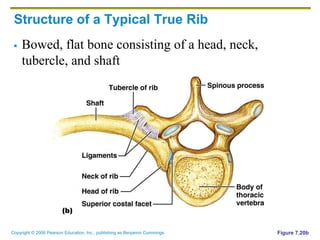 Tuberculum Rib Bone Skeletal system | PDF