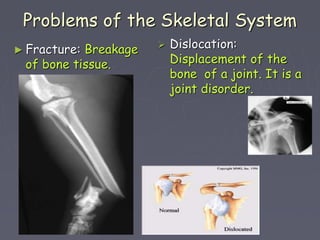 Skeleton Collapsing Skeletal System | PPT