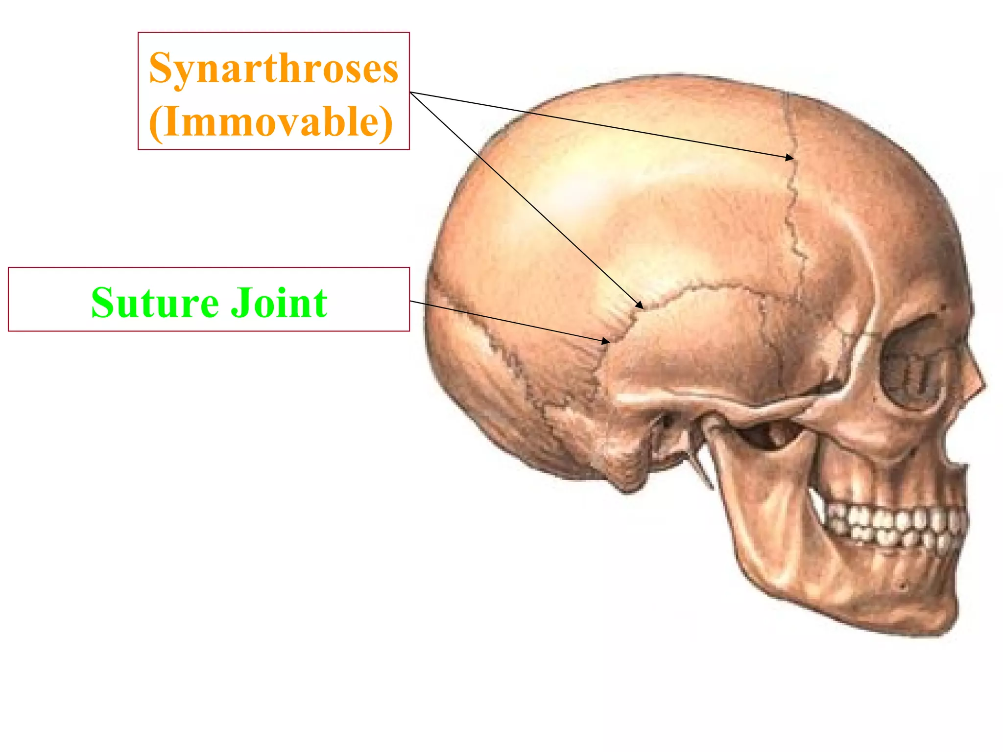 Suture Joint With respect to movement, what type of joints are these? Synarthroses (Immovable) Specific type of joint? 