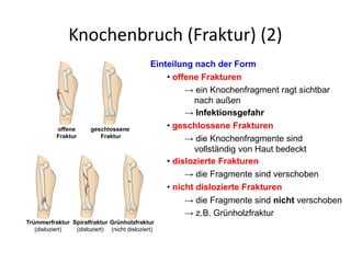 Knochenbruch (Fraktur) (2)
Einteilung nach der Form
• offene Frakturen
→ ein Knochenfragment ragt sichtbar
nach außen
• geschlossene Frakturen
→ die Knochenfragmente sind
vollständig von Haut bedeckt
• dislozierte Frakturen
→ die Fragmente sind verschoben
• nicht dislozierte Frakturen
→ die Fragmente sind nicht verschoben
→ z.B. Grünholzfraktur
→ Infektionsgefahr
offene
Fraktur
Trümmerfraktur
(disloziert)
Spiralfraktur
(disloziert)
geschlossene
Fraktur
Grünholzfraktur
(nicht disloziert)
 