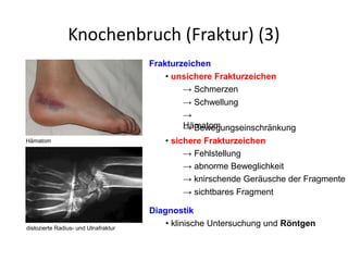 Knochenbruch (Fraktur) (3)
Frakturzeichen
• unsichere Frakturzeichen
→ Schmerzen
• sichere Frakturzeichen
→
Hämatom
→ Schwellung
→ Fehlstellung
→ abnorme Beweglichkeit
→ Bewegungseinschränkung
→ knirschende Geräusche der Fragmente
→ sichtbares Fragment
Diagnostik
• klinische Untersuchung und Röntgendislozierte Radius- und Ulnafraktur
Hämatom
 