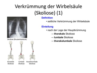 Verkrümmung der Wirbelsäule
(Skoliose) (1)
Definition
• seitliche Verkrümmung der Wirbelsäule
Einteilung
• nach der Lage der Hauptkrümmung
→ thorakale Skoliose
→ lumbale Skoliose
→ thorakolumbale Skoliose
thorakale
Skoliose
lumbale
Skoliose
thorakolumbale
Skoliose
Skoliose (Brustwirbelsäule)
 