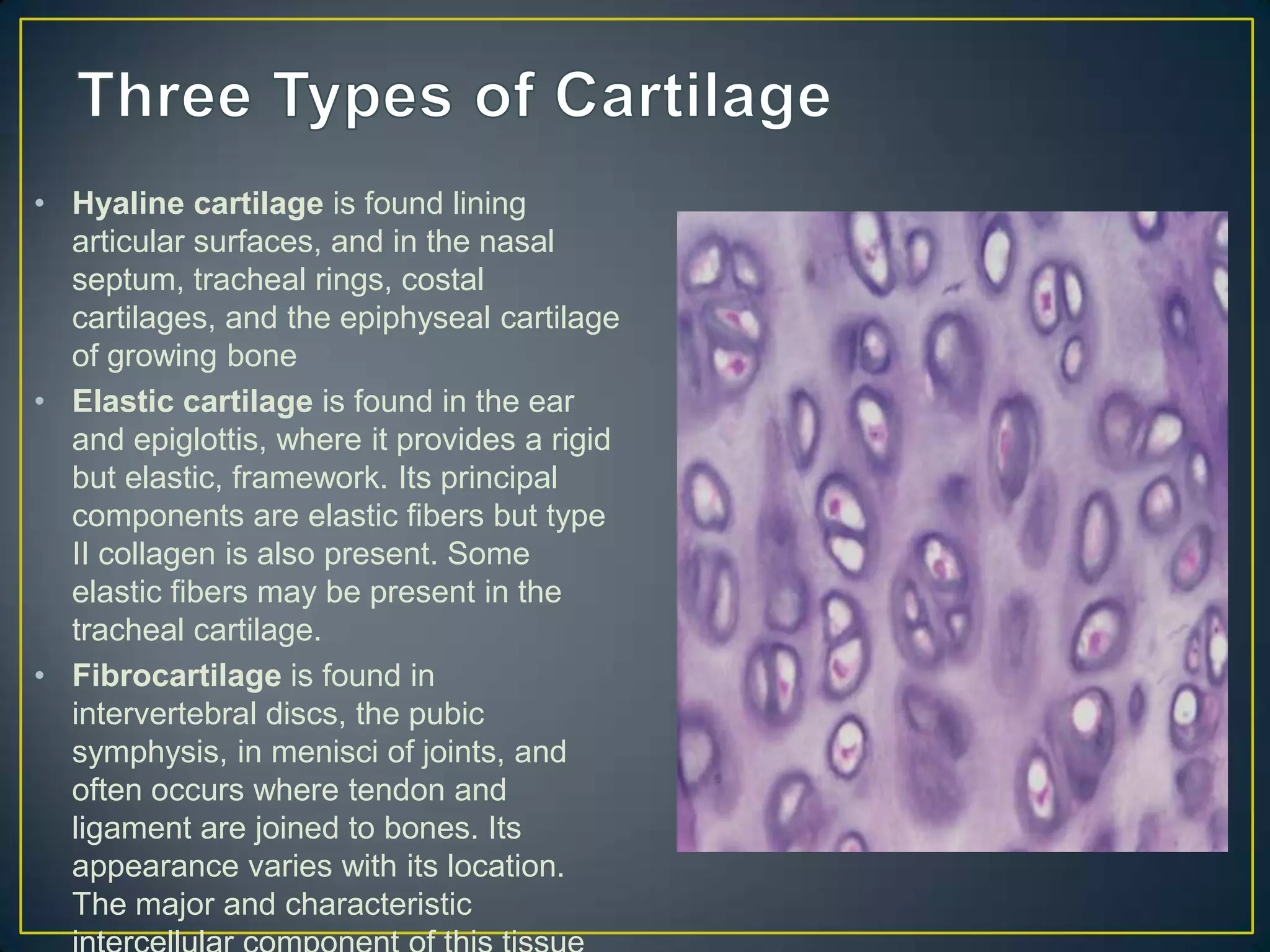 • Hyaline cartilage is found lining
  articular surfaces, and in the nasal
  septum, tracheal rings, costal
  cartilages, and the epiphyseal cartilage
  of growing bone
• Elastic cartilage is found in the ear
  and epiglottis, where it provides a rigid
  but elastic, framework. Its principal
  components are elastic fibers but type
  II collagen is also present. Some
  elastic fibers may be present in the
  tracheal cartilage.
• Fibrocartilage is found in
  intervertebral discs, the pubic
  symphysis, in menisci of joints, and
  often occurs where tendon and
  ligament are joined to bones. Its
  appearance varies with its location.
  The major and characteristic
 