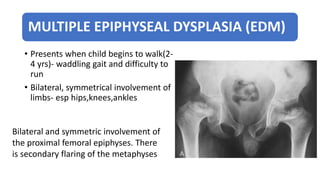 MULTIPLE EPIPHYSEAL DYSPLASIA (EDM)
• Presents when child begins to walk(2-
4 yrs)- waddling gait and difficulty to
run
• Bilateral, symmetrical involvement of
limbs- esp hips,knees,ankles
Bilateral and symmetric involvement of
the proximal femoral epiphyses. There
is secondary flaring of the metaphyses
 