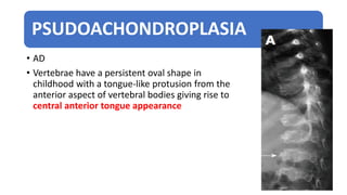 PSUDOACHONDROPLASIA
• AD
• Vertebrae have a persistent oval shape in
childhood with a tongue-like protusion from the
anterior aspect of vertebral bodies giving rise to
central anterior tongue appearance
 