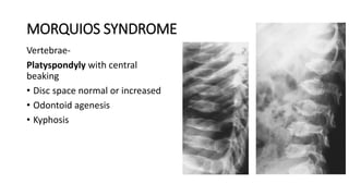 MORQUIOS SYNDROME
Vertebrae-
Platyspondyly with central
beaking
• Disc space normal or increased
• Odontoid agenesis
• Kyphosis
 